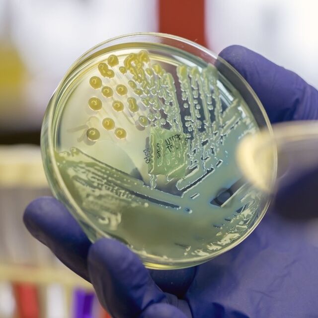 Petri dish